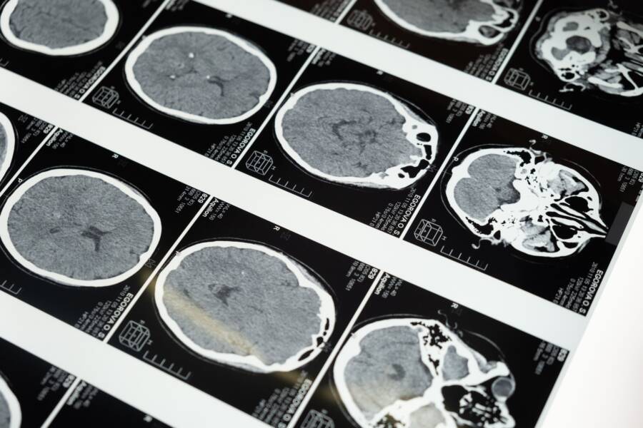 How Better Brain Signals Improve Your Wealth Decisions How Better Brain Signals Improve Your Wealth Decisions